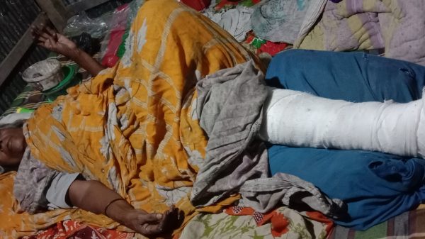 লালমোহনে পুত্রবধু কতৃক বৃদ্ধা শাশুড়ীর পা ভাঙ্গার অভিযোগ 