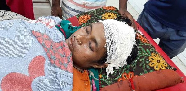 চরফ্যাশনে গৃহবধুর মাথা ফাটালেন পুলিশ