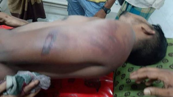 চরফ্যাশনে যুবককে মধ্যযুগীয় কায়দায় নির্যাতন