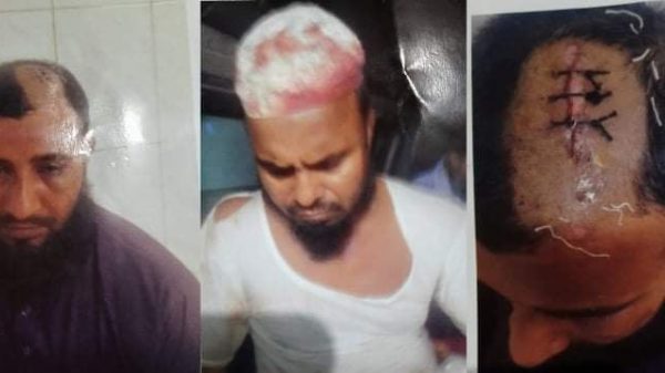 ভোলায় বাজারের মধ্যে অতর্কিত হামলা, আহত-৩