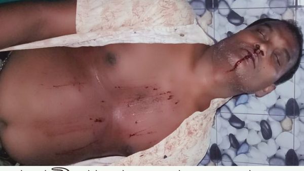 বানারীপাড়ায় আওয়ামী লীগ নেতার  মারধরে ছাত্রলীগ নেতা আহত